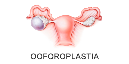 Dr Douglas Ribeiro  Ginecologia - Cirurgia Ginecológica