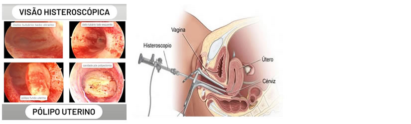 Dr Douglas Ribeiro  Ginecologia - Cirurgia Ginecológica