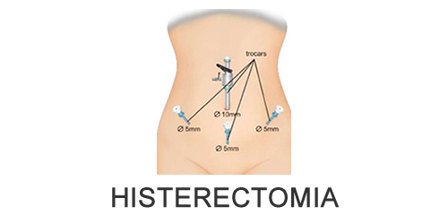 Dr Douglas Ribeiro  Ginecologia - Cirurgia Ginecológica